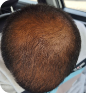 Before treatment – Amit Sharma