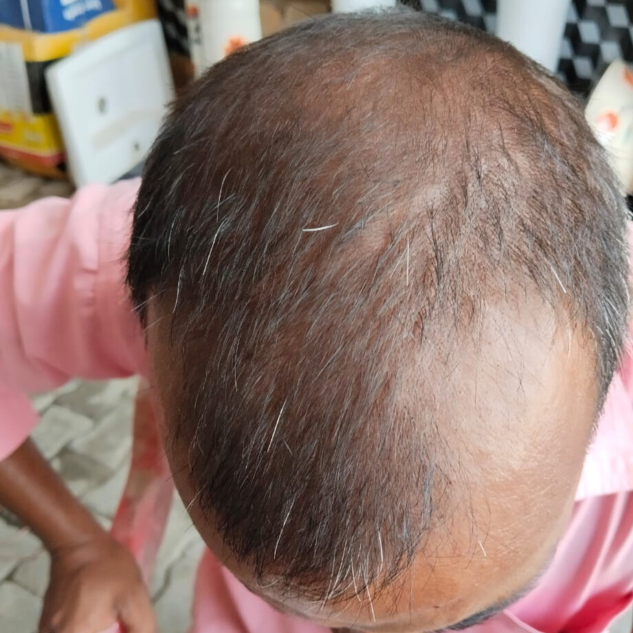 Before treatment – Rohit Verma