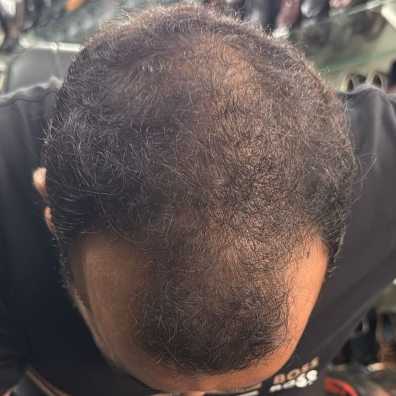 Before treatment – Praveen Saini