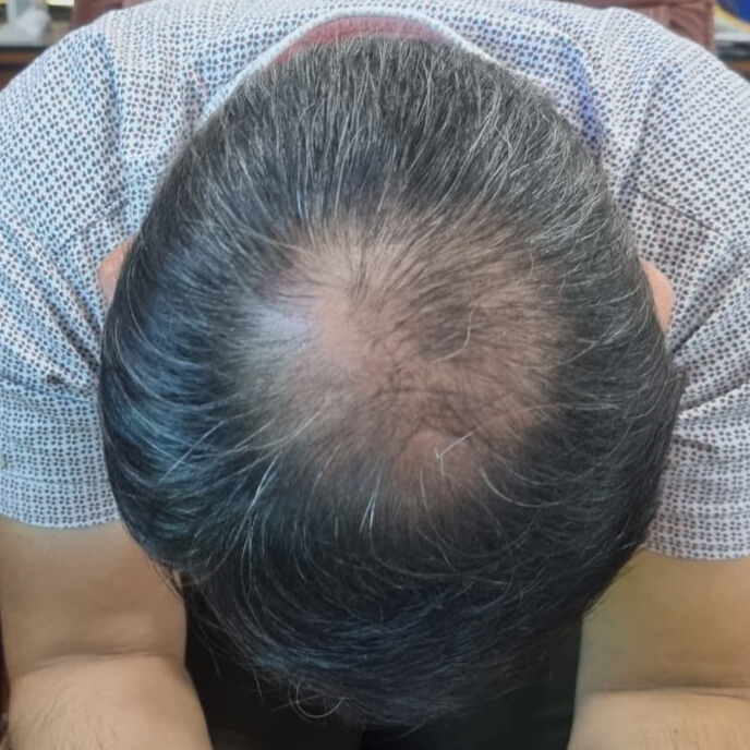 Before treatment – Rajeev Nair